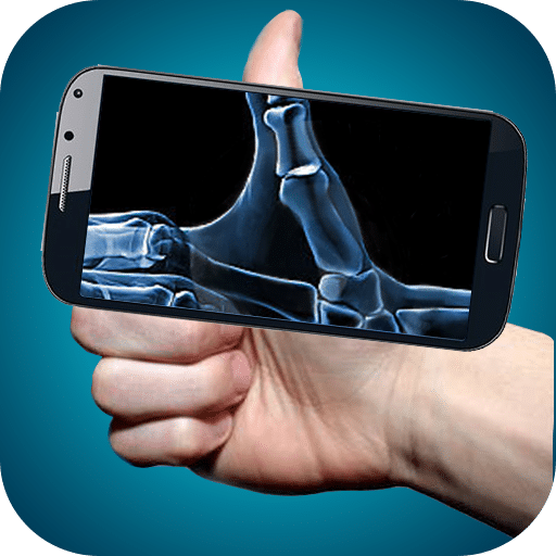 Radiografías Rápidas y Precisas al Instante